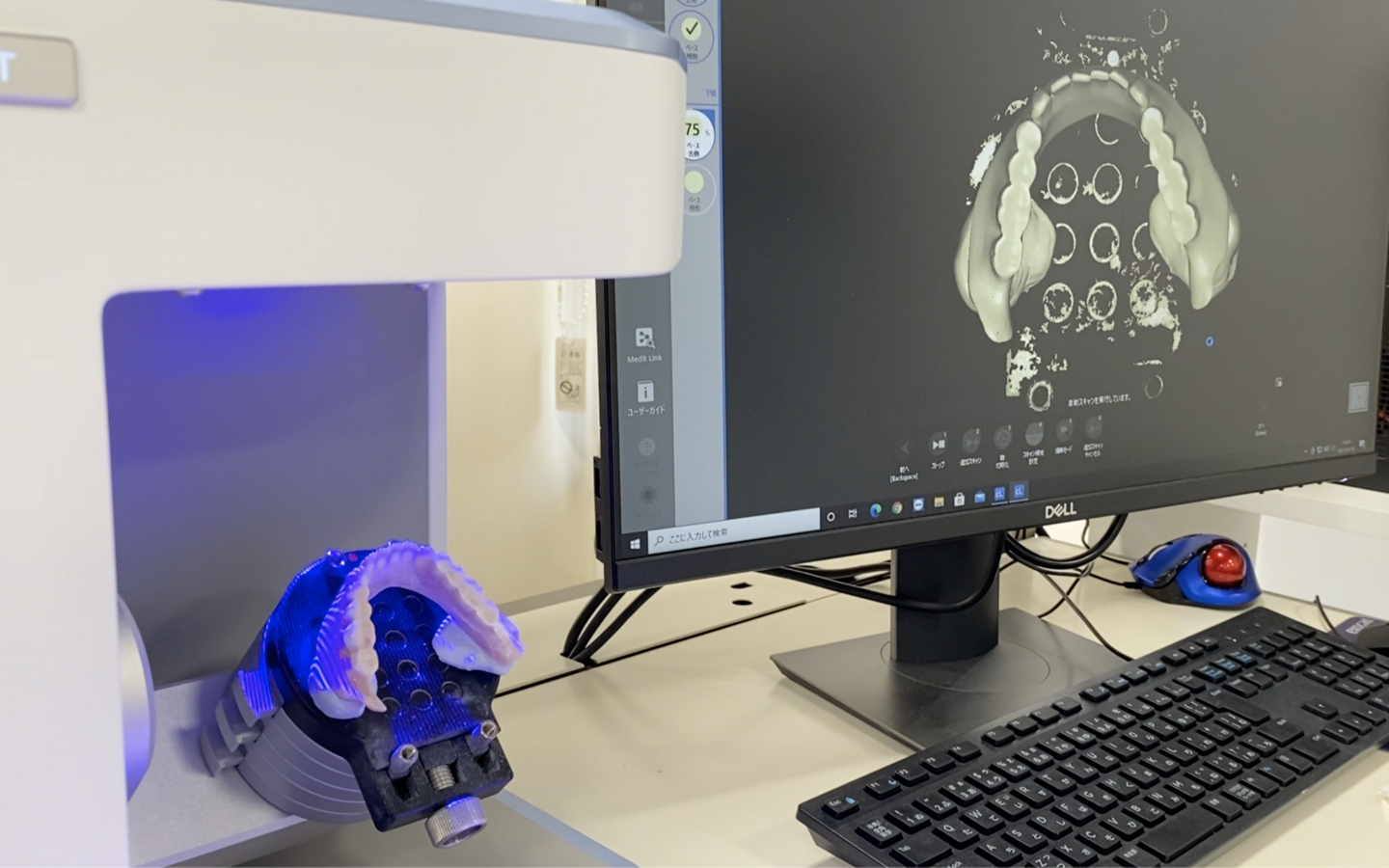 入れ歯の立体データ
